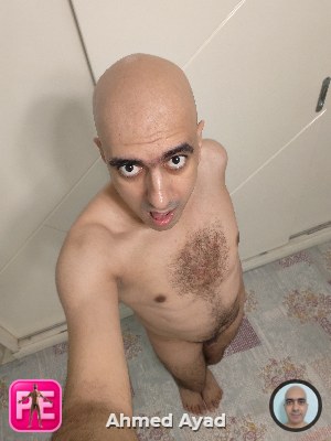bald
