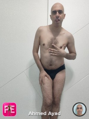 exposed